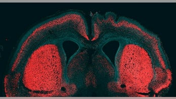 'Big brain' gene found in humans, not chimps