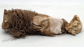 Mummified fetus reveals ancient surgical procedure