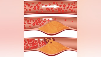 Don't take niacin for heart health, doctors warn