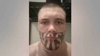 Dad with giant face tattoo gets laser removal, reveals he's landed first job