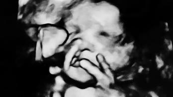 Parents say amazing ultrasound shows unborn baby giving V-sign