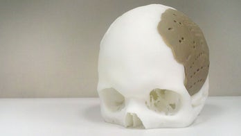 3D-printed medical devices spark FDA evaluation