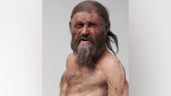Otzi 'the Iceman' had heart disease genes