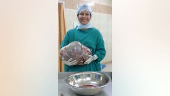 GRAPHIC IMAGE WARNING: Doctors find 26-pound tumor inside pregnant-looking patient's stomach