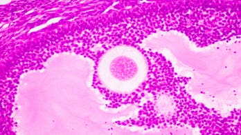 Can chemotherapy drug ‘turn back the clock’ in women’s ovaries?