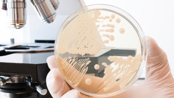 Mysterious outbreak: 5 things to know about Elizabethkingia