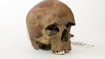 White man's skull has Australians scratching heads