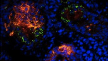 Japan govt approves stem cell clinical trials