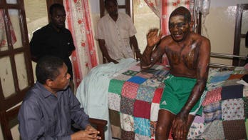 Zanzibar president urges action after acid attacks