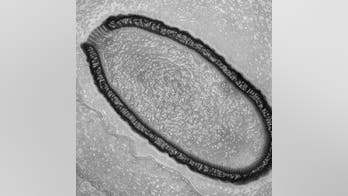Giant virus resurrected from permafrost after 30,000 years