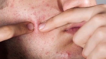 Man develops fungal infection after using woodworking blade to pop pimple