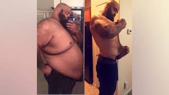 Arizona man who lost over 300 pounds fundraises for skin surgery