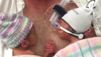Video of premature twins holding hands goes viral