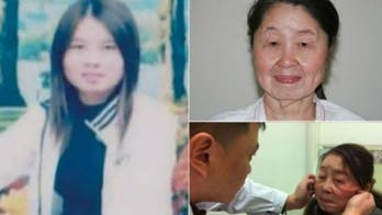 Rare condition makes 29-year-old woman look 80 after childbirth