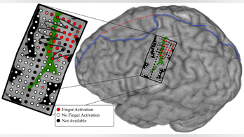 Scientists design mind-controlled prosthetic that can move individual fingers