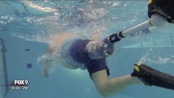 After accident with a fork lift, 1-legged man thrives with prosthetic