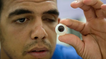 Prosthetic eye maker brings relief to wounded Gazans