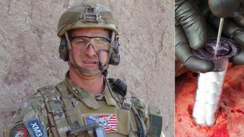 Stopping the blood: Ex-Army medic still helping treat battle wounds