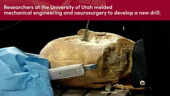 This terrifying robot can drill through your skull in 2 minutes -- and that's a good thing