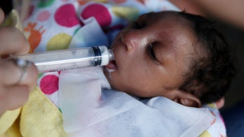 The effects of Zika on babies' brains go beyond microcephaly, report finds