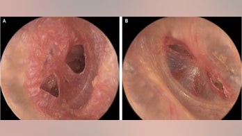 Wedding fireworks ruptured man's eardrums