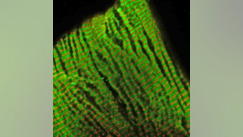 Algorithm could help doctors predict genetic-linked heart defects in children