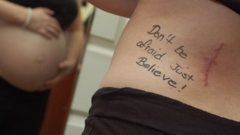 Melanoma during pregnancy common, but treatable