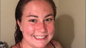 'Dalmatian' woman shows off scars to raise awareness for rare skin disease