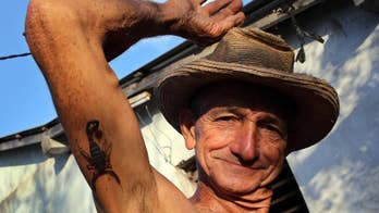 Elderly man in Cuba treats arthritis pain with scorpion venom – swears by it