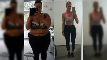 Makeup artist who documented 194-pound weight loss journey on social media undergoes skin surgery