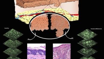 Glowing molecules could reveal skin cancer, without a biopsy