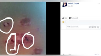 Mom claims toddler contracted flesh-eating bacteria from Texas lake