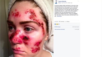 Viral skin-cancer selfie boosted online searches