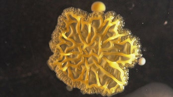 Smartphone bacteria 'art project': THIS lives on your phone