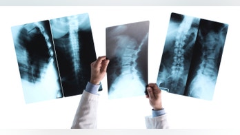 1 of 8 Washington children with mysterious polio-like illness dies