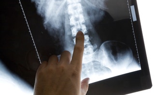 Risks of X-rays for cancer diagnosis may be a mystery to most patients