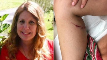 New Jersey woman strangles rabid fox after animal bites her leg