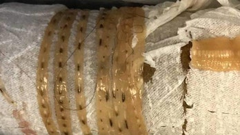 Five-foot long tapeworm came 'wiggling out' of man's body after he ate sushi