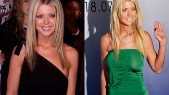 Celebrity plastic surgery disasters