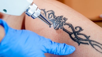This Ohio spa is offering free laser tattoo removal for customers with racially influenced ink