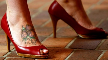 Color, size and smoking affect tattoo removal