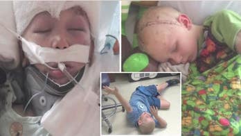 7-year-old gets life-like 3-D printed skull after severe fall