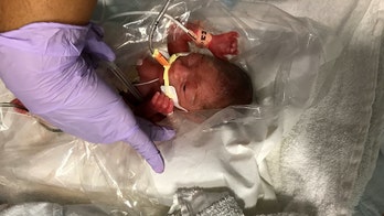 Preemie baby placed in plastic bag survives, mom calls him 'my little fighter'