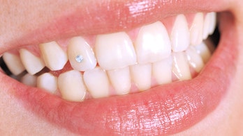 Teeth jewelry: The latest trend that's all the rage with celebrities
