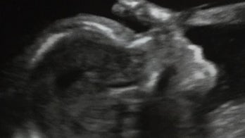 49ers' Torrey Smith shares unborn child's health scare, asks for prayers