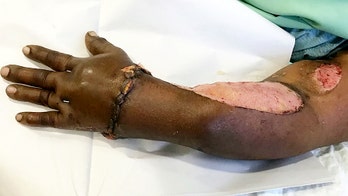 Woman's hand that was chopped off in machine was saved by co-workers