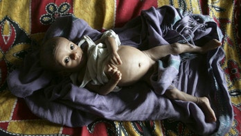 Efforts to beat tuberculosis fall far short, WHO warns