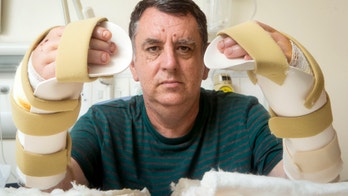 Man doing well after UK's first double hand transplant
