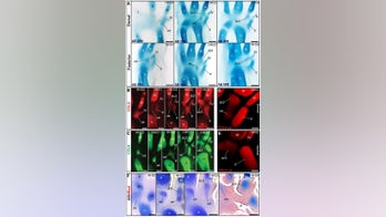 Rare evolutionary twist morphed dino arms into bird wings