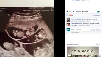 Mom of 3 shocked to learn she's expecting sextuplets
